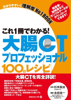 これ1冊でわかる！ 大腸CTプロフェッショナル 100のレシピ