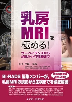 乳房MRIを極める！　